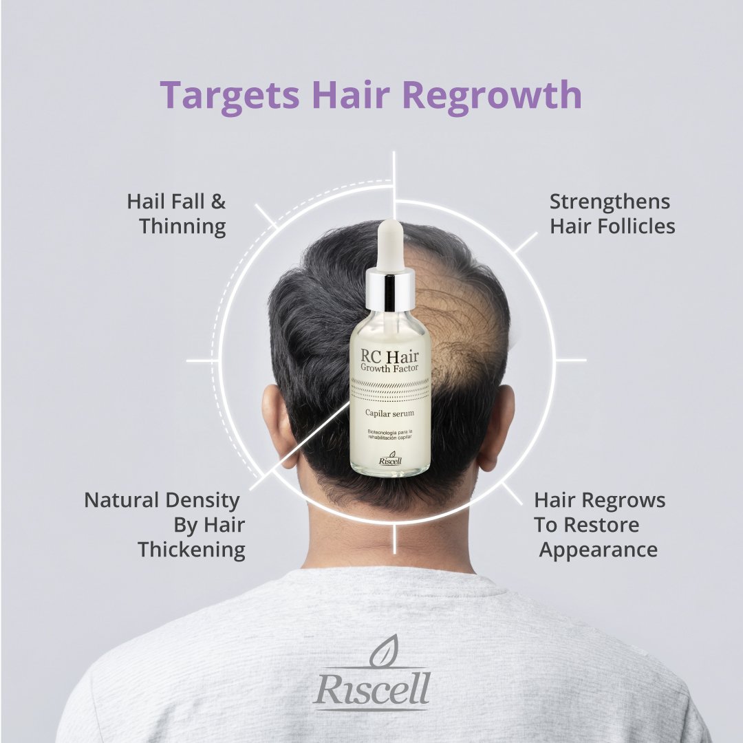 Rc Hair Regrowth Serum Stops Hair Fall, Thickens Hair & Repairs Scalp - Image 3